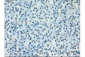 Immunohistochemical staining of paraffin-embedded colon tissue using anti-SSX2mouse monoclonal antibody. (SSX2 anticorps)
