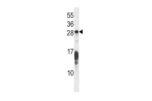 Western blot analysis in Hela cell line lysates (35ug/lane). (RAP1B anticorps  (C-Term))