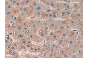 DAB staining on IHC-P; Samples: Human Liver Tissue (MAPKAP Kinase 3 anticorps  (AA 129-329))