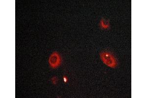 ABIN6268992 staining LOVO cells by ICC/IF. (MMP8 anticorps  (C-Term))