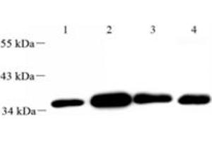 Western blot analysis of FLJ22167 (ABIN7073961) at dilution of 1: 2000,Lane 1: Mouse uterus tissue lysate,Lane 2: Mouse lung tissue lysate,Lane 3: Mouse ovary tissue lysate,Lane 4: Rat ovary tissue lysate (FLJ22167 anticorps)