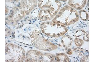 Immunohistochemical staining of paraffin-embedded Human Kidney tissue using anti-BIRC5 mouse monoclonal antibody. (Survivin anticorps)