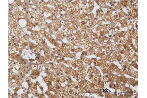 Immunoperoxidase of purified MaxPab antibody to CYP2E1 on formalin-fixed paraffin-embedded human liver.