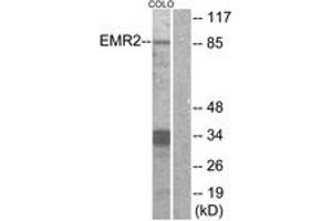 Western blot analysis of extracts from COLO cells, using EMR2 Antibody. (EMR2 anticorps  (AA 765-814))