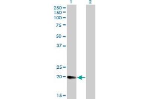 Western Blot analysis of DHRS11 expression in transfected 293T cell line by DHRS11 MaxPab polyclonal antibody. (DHRS11 anticorps  (AA 1-181))