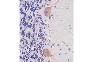 D staining Nestin in human cerebellum tissue sections by Immunohistochemistry (IHC-P - paraformaldehyde-fixed, paraffin-embedded sections).