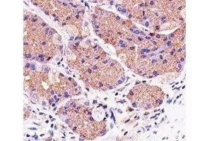 Immunohistochemical analysis of paraffin-embedded human stomach using Pink1 antibody at 1:25 dilution. (PINK1 anticorps)