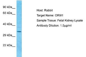 Host: Rabbit Target Name: OR9I1 Sample Type: Fetal Kidney lysates Antibody Dilution: 1.