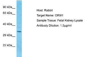 Host: Rabbit Target Name: OR9I1 Sample Type: Fetal Kidney lysates Antibody Dilution: 1.