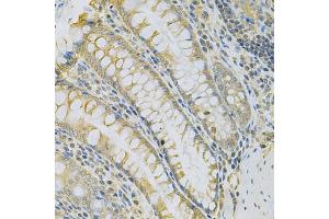 Immunohistochemistry of paraffin-embedded rat intestine using CAMK1D Antibody (ABIN5975586) at dilution of 1/100 (40x lens). (CAMK1D anticorps)