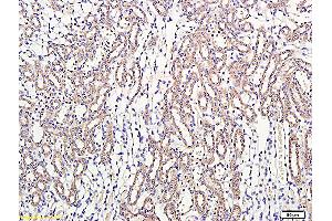 Formalin-fixed and paraffin embedded: rat kidney labeled with Anti-Thrombomodulin/CD141 Polyclonal Antibody, Unconjugated (ABIN669636) at 1:300 followed by conjugation to the secondary antibody and DAB staining (Thrombomodulin anticorps)