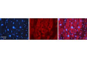Rabbit Anti-EFEMP1 Antibody   Formalin Fixed Paraffin Embedded Tissue: Human heart Tissue Observed Staining: Cytoplasmic Primary Antibody Concentration: 1:100 Other Working Concentrations: 1:600 Secondary Antibody: Donkey anti-Rabbit-Cy3 Secondary Antibody Concentration: 1:200 Magnification: 20X Exposure Time: 0. (FBLN3 anticorps  (Middle Region))