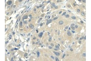 IHC-P analysis of Human Esophagus, with DAB staining. (ALDH1A2 anticorps  (AA 1-422))