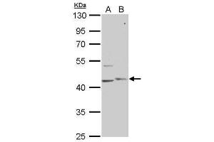 WB Image PHKG1 antibody [N1C3] detects PHKG1 protein by Western blot analysis.