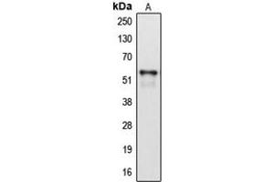 Western blot analysis of Cytochrome P450 2A6 expression in HepG2 (A) whole cell lysates. (CYP2A6 anticorps  (Center))