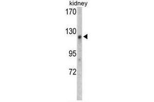 Western blot analysis of WTX antibody (Center) in mouse kidney tissue lysates (35ug/lane).