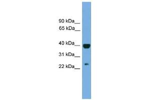 WB Suggested Anti-SOCS1 Antibody Titration:  0. (SOCS1 anticorps  (Middle Region))