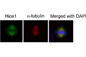 ICC/IF Image Immunofluorescence analysis of human osteosarcoma cell line U2OS, using HICE1, antibody at 1:50-1:200 dilution.