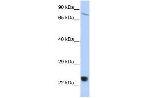WB Suggested Anti-SAntibody Titration:  0. (SP110 anticorps  (Middle Region))
