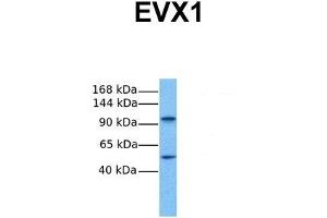 Host:  Rabbit  Target Name:  EVX1  Sample Tissue:  Human Fetal Lung  Antibody Dilution:  1. (EVX1 anticorps  (N-Term))