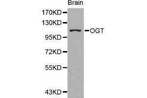 Western blot analysis of extracts of human brain cell line, using OGT antibody. (OGT anticorps)