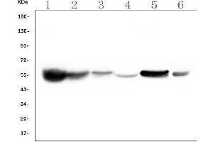 Western blot analysis of ALDH2 using anti-ALDH2 antibody (ABIN7603122). (ALDH2 anticorps  (N-Term))