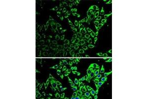 Immunofluorescence analysis of HeLa cells using Hsp60 Polyclonal Antibody (HSPD1 anticorps)