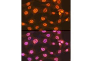 Immunofluorescence analysis of NIH-3T3 cells using ENT2/SLC29 Rabbit mAb (ABIN7270448) at dilution of 1:100 (40x lens).