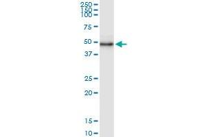 Immunoprecipitation of WDR19 transfected lysate using anti-WDR19 MaxPab rabbit polyclonal antibody and Protein A Magnetic Bead , and immunoblotted with WDR19 MaxPab mouse polyclonal antibody (B01) .
