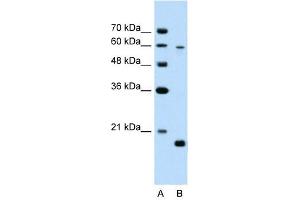 SLC38A4 antibody used at 2. (SLC38A4 anticorps  (Middle Region))