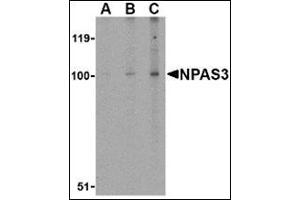 Western blot analysis of NPAS3 in rat brain tissue lysate with this product at (A) 0. (NPAS3 anticorps  (Center))