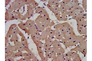 anti-Interleukin 1 Receptor Accessory Protein-Like 1 (IL1RAPL1) (AA 564-679) antibody