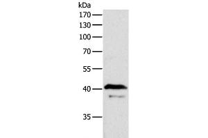 Western Blot analysis of Mouse brain tissue using ADAP1 Polyclonal Antibody at dilution of 1:500 (ADAP1 anticorps)