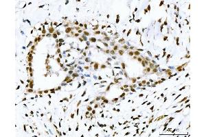 IHC analysis of 53BP1/TP53BP1 using anti-53BP1/TP53BP1 antibody (ABIN7599869). (TP53BP1 anticorps  (AA 1239-1972))