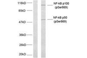 Western blot analysis of extracts from MDA-MB-435 cells treated with TNF-alpha, using NF-kappaB p100/p52 (Phospho-Ser869) Antibody. (NFKB2 anticorps  (pSer870))