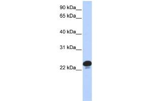 WB Suggested Anti-CAPS Antibody Titration: 0. (Calcyphosine anticorps  (N-Term))