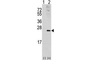 Western blot analysis of RAC1 antibody and 293 cell lysate (2 ug/lane) either nontransfected (Lane 1) or transiently transfected with the RAC1 gene (2). (RAC1 anticorps  (AA 49-78))