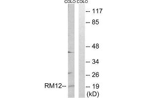 Western Blotting (WB) image for anti-Mitochondrial Ribosomal Protein L12 (MRPL12) (Internal Region) antibody (ABIN1850542) (MRPL12 anticorps  (Internal Region))