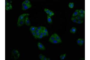 Immunofluorescence staining of HepG2 cells with ABIN7164019 at 1:166, counter-stained with DAPI. (KCNV2 anticorps  (AA 1-155))