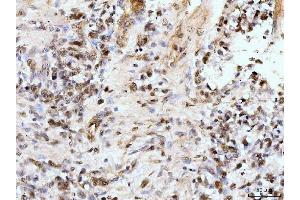 IHC analysis of IFI16 using anti-IFI16 antibody (ABIN7600374). (IFI16 anticorps  (AA 183-743))