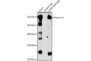 Immunoprecipitation analysis of 200 μg extracts of Jurkat cells, using 3 μg Filamin A antibody (ABIN6127907, ABIN6140677, ABIN6140679 and ABIN6214030). (Filamin A anticorps  (AA 2348-2647))