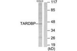 Western Blotting (WB) image for anti-T-Box 1 (TBX1) (AA 311-360) antibody (ABIN2889323) (T-Box 1 anticorps  (AA 311-360))