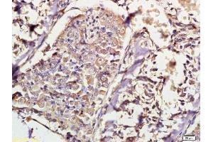 Formalin-fixed and paraffin embedded mouse embryo tissue labeled with Anti- IKK beta Polyclonal Antibody, Unconjugated (ABIN1387584) at 1:200 followed by conjugation to the secondary antibody