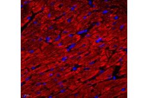 Immunofluorescence of paraffin embedded rat heart using ATP5A1 (ABIN7073141) at dilution of 1: 300 (400x lens)