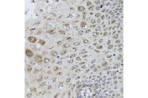 Immunohistochemistry of paraffin-embedded human esophagus using PRKAB1 antibody at dilution of 1:100 (x40 lens). (PRKAB1 anticorps)
