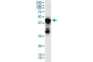 SLC7A6OS monoclonal antibody (M04), clone 3D10.