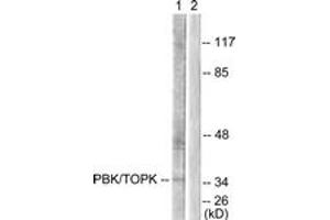 Western blot analysis of extracts from COS7 cells, treated with Nocodazole 1ug/ml 16h, using PBK/TOPK (Ab-9) Antibody. (PBK anticorps  (AA 1-50))