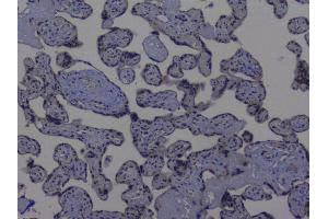 IHC analysis of NRF1 using anti-NRF1 antibody (ABIN6719347).