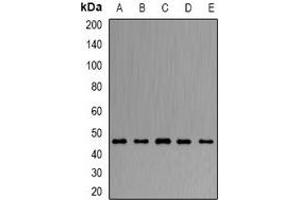 Western blot analysis of ARFGAP1 expression in Hela (A), HepG2 (B), mouse liver (C), mouse brain (D), rat lung (E) whole cell lysates. (ARFGAP1 anticorps)