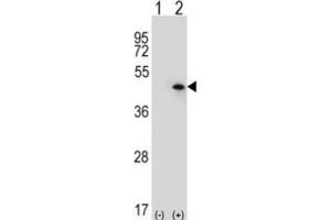 Western Blotting (WB) image for anti-USP12,USP46 antibody (ABIN3001474) (USP12,USP46 anticorps)